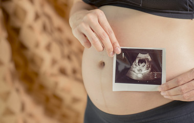 Pregnant woman  holding ultrasound photo of baby  in front of the window