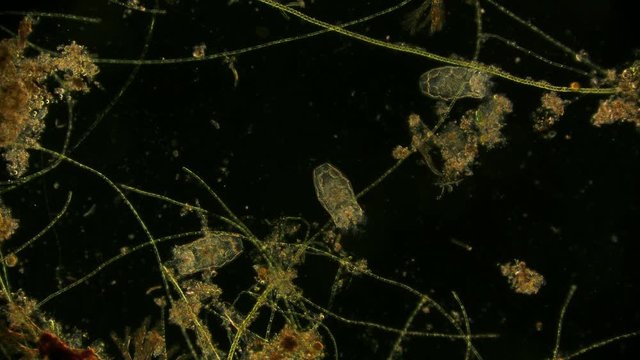 R&auml;dertierchen Rotifer unter dem Dunkelfeld Mikroskop in 4K
