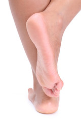dehydrated skin on the heels of female feet.