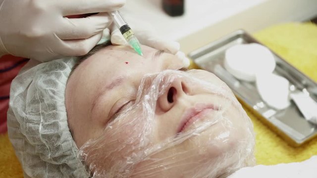Beautician making injections for the woman closeup