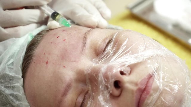 Beautician making injections for the woman in salon closeup