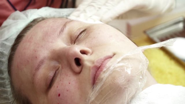 Beautician making injections to the cheek for the woman closeup
