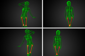 3d rendering medical illustration of the femur bone