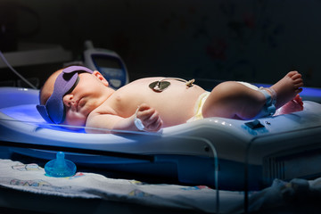 newborn baby with jaundice getting ulta violet phototherepy treatment © Joshua Resnick