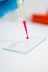 Test tubes with blood for analysis and research in the laboratory