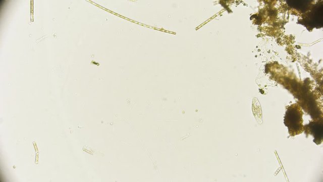Wimpertierchen unter dem Mikroskop in 4K