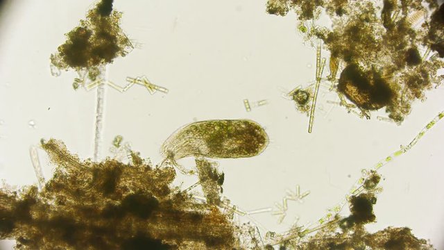 Pantoffeltierchen - Paramecium / Wimpertierchen unter dem Mikroskop in 4K