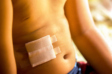 Wound on belly of child.Close up and background for health.