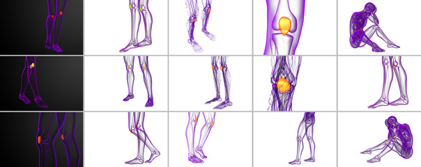 3d rendering medical illustration of the patella bone