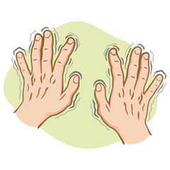 Close part of the body, pair of hands shaking symptoms of, Parkinson's disease, cold or fear, Caucasian. Ideal for educational and institutional and medical materials