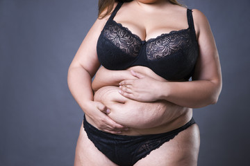 Woman with fat abdomen, overweight female stomach, stretch marks on belly closeup