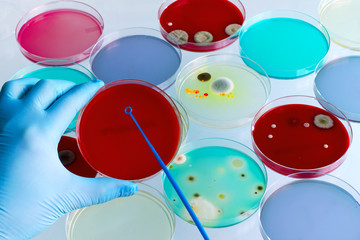 technician hands streaking petri dish in the lab / Hand of a technician holding and inoculating...