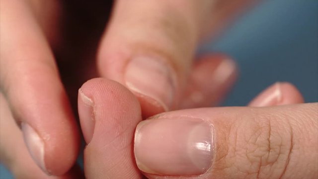 Close up using of lancet on female finger. Drop of blood on finger. Measurement blood sugar.