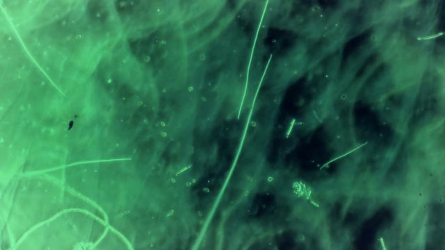 Bacteria From River Bed Mud Sample 400x Magnification Timelapse
