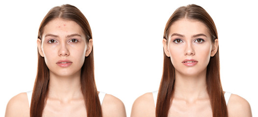 Young woman before and after makeup application on white background