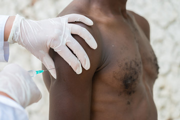 Vaccination of African black man outdoors.Female Caucasian doctor's hands, unrecognizable people