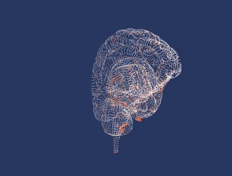 Cervello, malattie degenerative, Parkinson, sinapsi, neuroni, Alzheimer's, 3d rendering