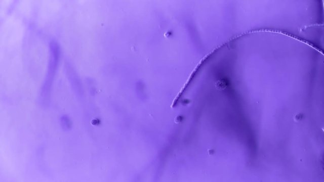 Dancing Protozoa From Lake Water Sample Time Lapse 400x Phase Microscope