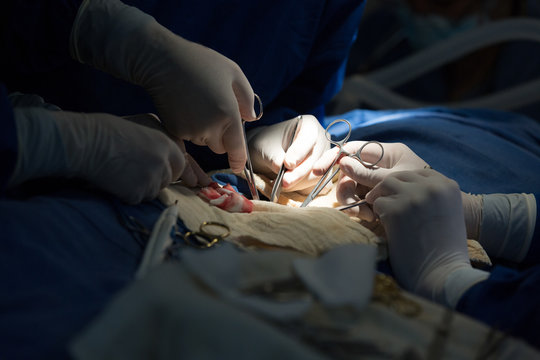 Abdominal Surgery