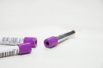 Test tube CBC on white tone in laboratory