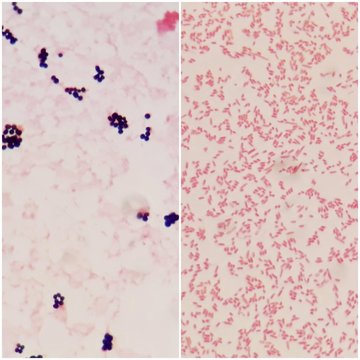 Smear of gram positive bacteria on the left and gram negative bacteria on the right, under 100X light microscope.