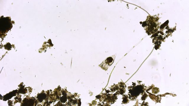 R&auml;dertierchen Rotifer unter dem Mikroskop in 4K
