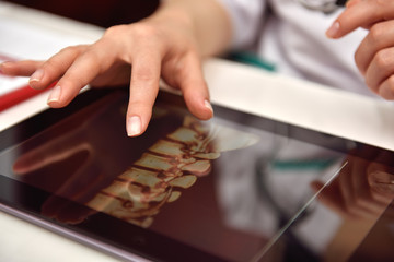 Doctor Using Tablet With X-ray