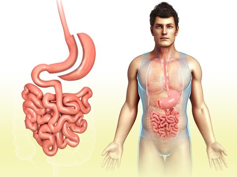 Sleeve gastrectomy, illustration