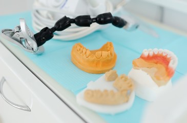 Gypsum models of dentures on the table close-up. Dental prosthetics, orthopedic dentistry