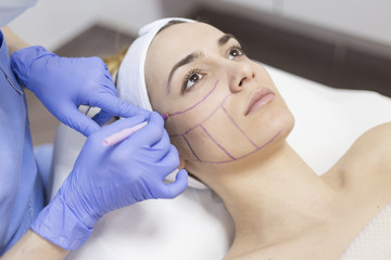 Obraz na płótnie Canvas Beautician draw correction lines on woman face. Woman in beauty salon