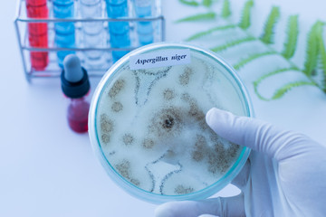 Background of Fungus (Aspergillus) in Petri dishes in laboratories for education in lab.
