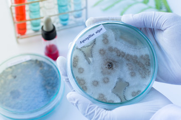 Background of Fungus (Aspergillus) in Petri dishes in laboratories for education in lab.