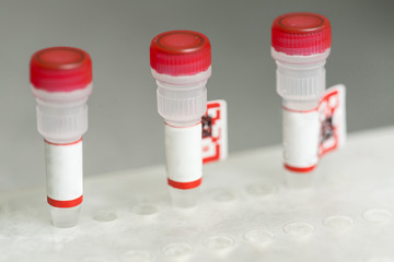 Test tubes arranged on medical trolley