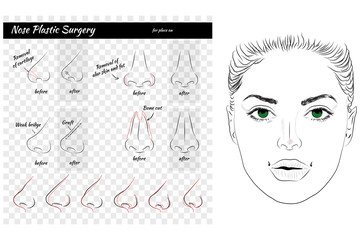 Fototapeta premium Plastic Surgery. Nose. Vector illustration. Nose Templates. Set of Noses. 