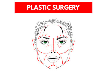 Woman Face With Red lines. Plastic Surgery. Vector illustration.