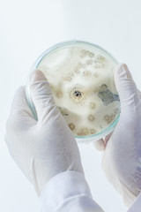 Scientist show colony of fungus (Asperillus niger) in culture medium plate, Microbiology.