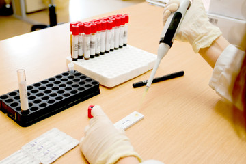 Biochemical engineer working in a medical laboratory. Scientist hands working in a medical environment. Genetic research working in a pharmaceutical lab.