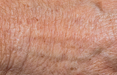 Closeup of senior hand skin for background and texture