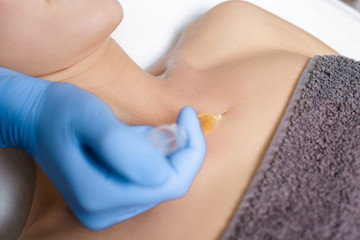 procedure Plasmolifting injection. plasma injection into skin of patient