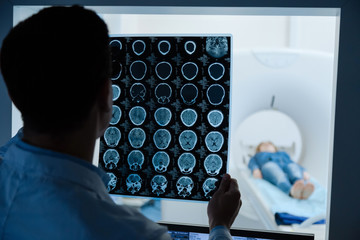 Professional male oncologist looking at the MRI scan image