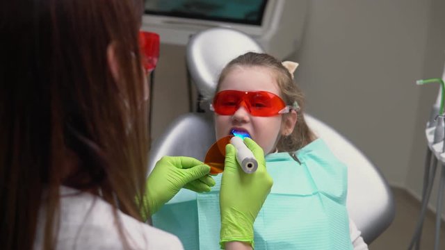 Little cute girl at dentist clinic gets dental treatment to fill a cavity in a tooth. Dental restoration and material polymerization with UV light. Shot in 4k