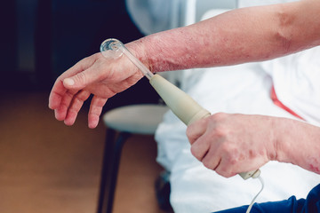 patient with a skin disease uses a Darsonval apparatus for the treatment of dermatitis, apathic, seborrhea, eczema.