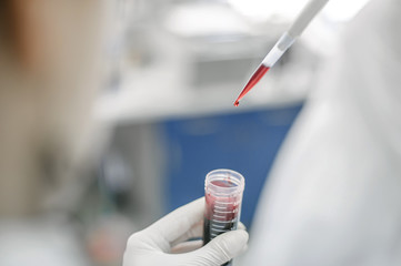 Medical laboratory scientists in the laboratory filling test tubes with pipette