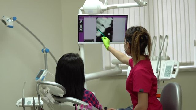 Young female doctor pointing on the screen with x-ray, explaining her patient needed treatment. Young woman sitting in the dentist chair and looking at the monitor. Shot in 4k