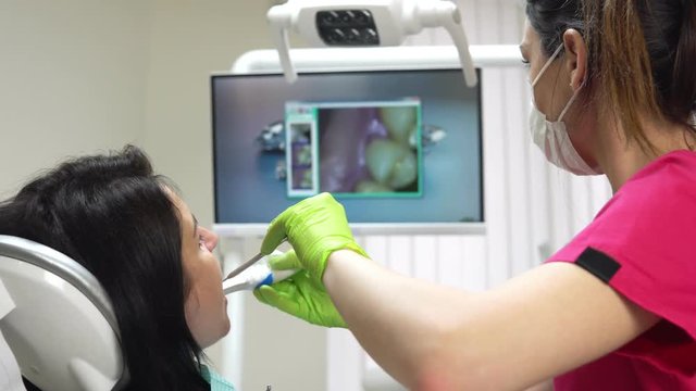 Young female dentist examining the mouth of a patient with an intraoral camera and showing image on the screen. Shot in 4k