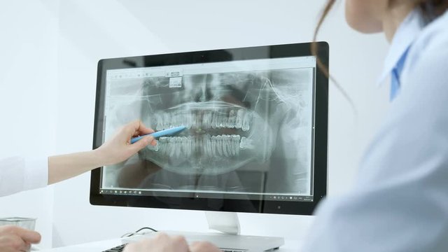 Doctor shows your patient the situation of her teeth. Doctor giving consultation to patient. Dentist shows x-ray her teeth.