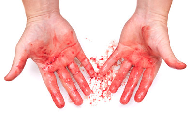 bloody hands