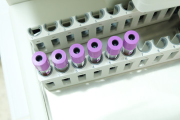 test tube cbc lab