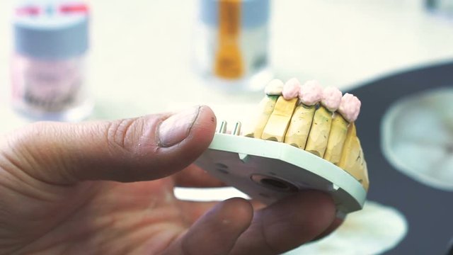 Dental technician applying ceramics glaze to a cast made with CNC dental machine