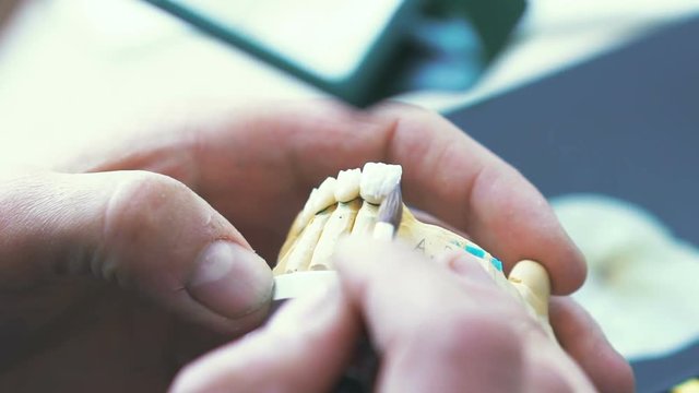 Dental technician applying ceramics glaze to a cast made with CNC dental machine